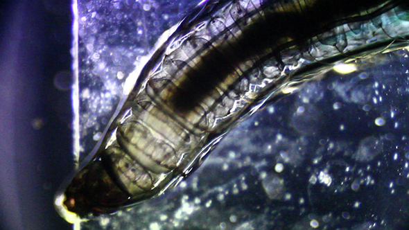 Microscopy: Parasite Worm 2
