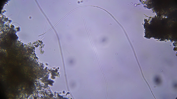 Microscopy: Cyanobacteria SP. 1