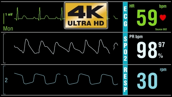 Patient Monitor Displays Medical Exam Vital Signs  alt