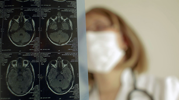 Surgeons Checking MRI alt