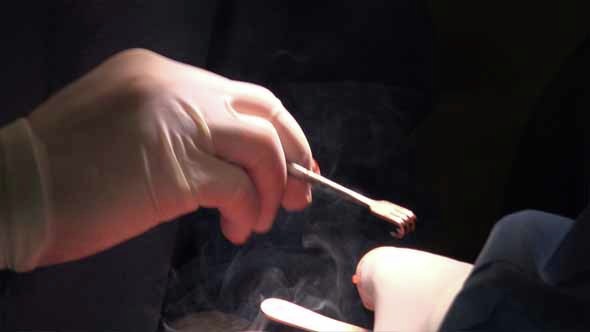 Surgery and Electrosurgical Pencil 2 alt