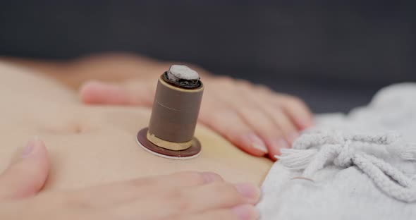 Woman undergo moxibustion therapy on her body alt