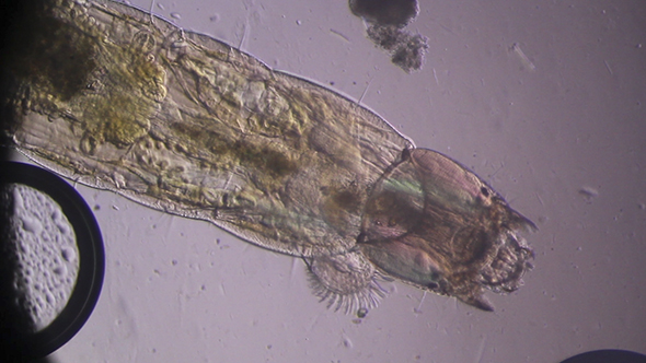 Microscopy: Mosquito Larvae 03