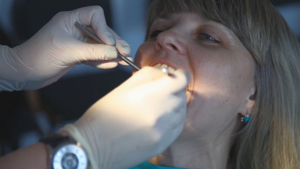 Dentist Checking a Woman For Cavities. 