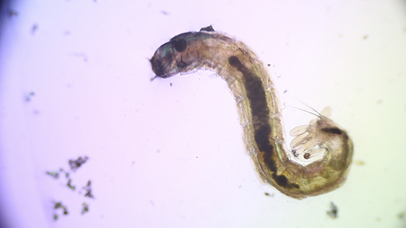 Microscopy: Mosquito Larvae 08