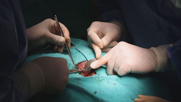 Surgeon Sutures During Hemorrhoid Surgery  alt