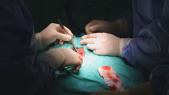 Surgeon Sutures During Surgery 3  alt