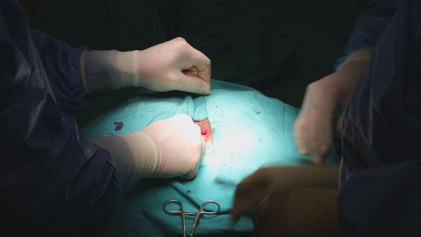 Surgeon Sutures During Surgery 4 alt