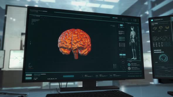 Scanner At Innovative Health Laboratory Starts Analysis Of Patients Brain alt