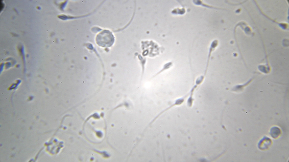 Microscopy: Sperm Sample Human 01
