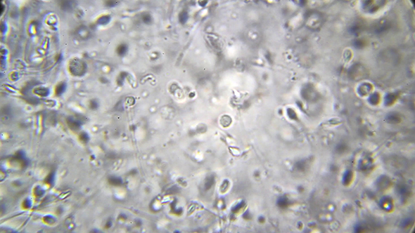 Microscopy: Sperm Sample Human 02