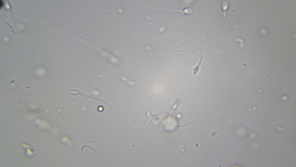 Microscopy: Sperm Sample Human 03