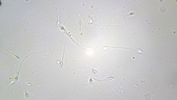 Microscopy: Sperm Sample Human 04