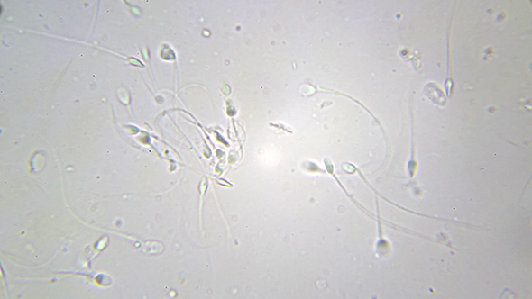 Microscopy: Sperm Sample Human 05