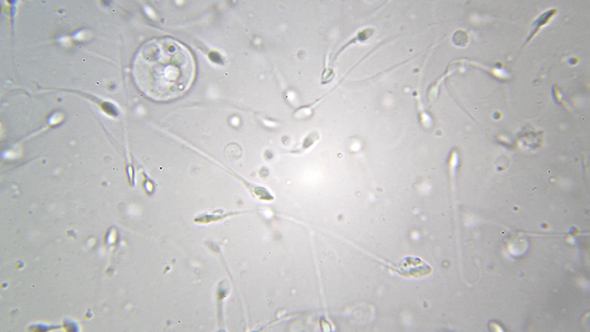 Microscopy: Sperm Sample Human 06