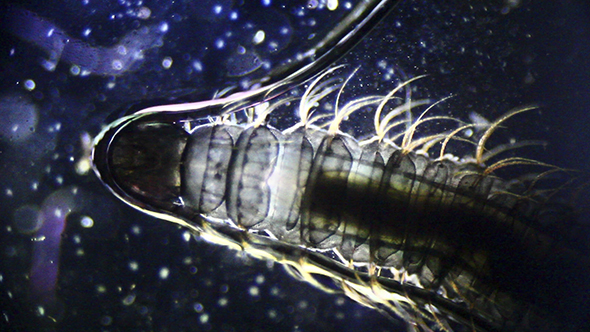 Microscopy: Parasite Worm 3
