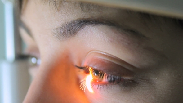 Scanning The Retina Among Women With Green Eyes Special Ophthalmic Device  alt