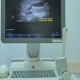 Ultrasound Scanner - VideoHive Item for Sale