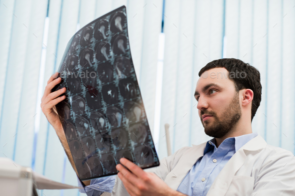 Closeup portrait of intellectual man healthcare personnel with white labcoat, looking at brain x-ray - Stock Photo - Images