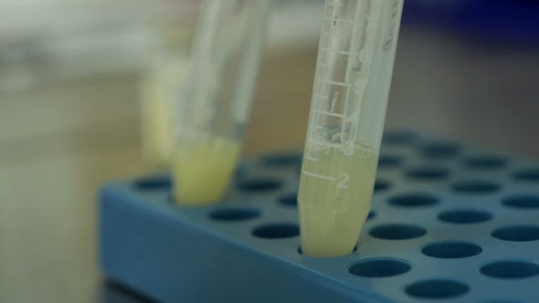 The Doctor Conducts Manipulation Seminal Fluid Sperm Donors alt