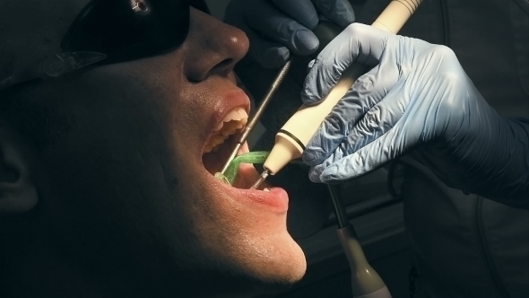 Mid Age Man Gets Medical Teeth Removing Calculus alt