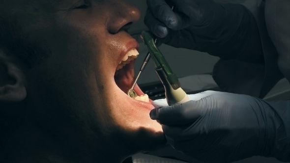 Man Gets Dental Medical Examination And Treatment