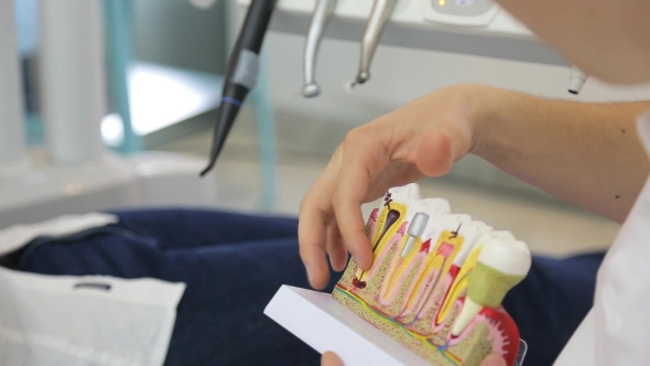 Dentist Showing a Model Of Most Frequent Diseases Of Teeth.