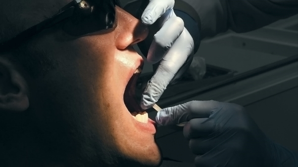 Mid Age Man Gets Medical Teeth Removing Calculus
