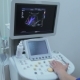 Doctor Working On The Machine For The Ultrasound Shows Graphics And Renal Artery - VideoHive Item for Sale