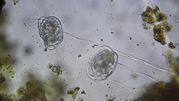 Microscopy: Vorticella SP (Unidentified Species) 07