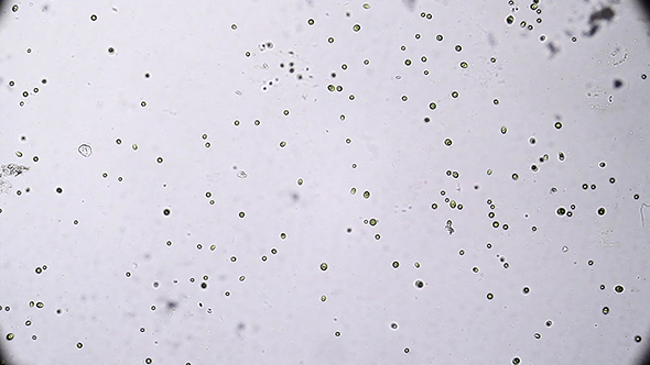 Microscopy: Pteromonas Angulosa Alga-Algae 01