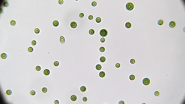 Microscopy: Pteromonas Angulosa Alga-Algae 02