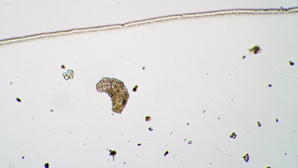 Little Tardigrade is Moving It's Paws and Turning to the Side Under the Microscope alt