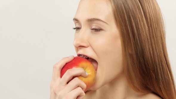 Blonde Girl With Braces Eating Apple. White.  alt