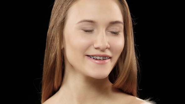 Beautiful Girl With Braces On His Teeth White Posing For The Camera. Black alt
