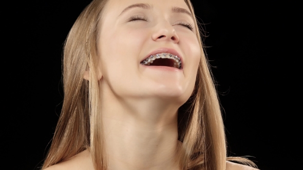 Female With Braces On His Teeth White Laughing And Showing a Smile. Black alt