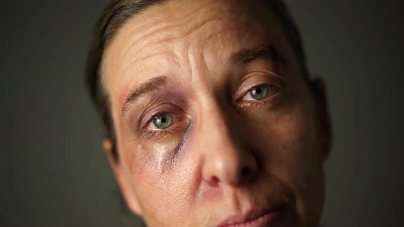 Desperate Woman Black Eye Tears
