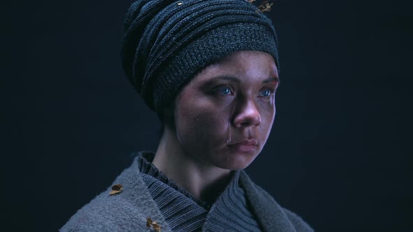 Homeless Person With Puffy Face Deeply Crying, Regretting About Ruined Life alt