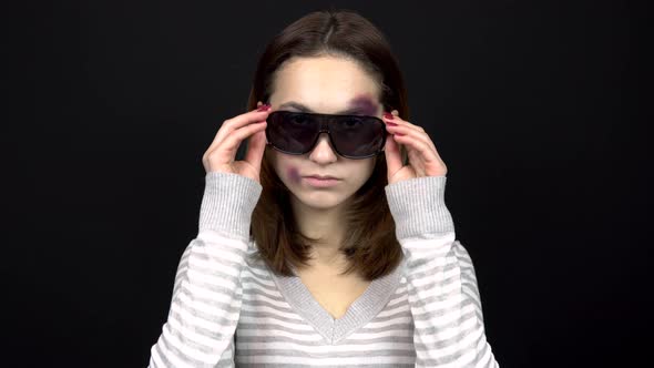 A Young Woman Takes Off Her Sunglasses To Show Bruises on Her Face. A Woman with Bruises on Her Face alt