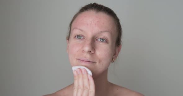Woman applying skin care product on face. alt