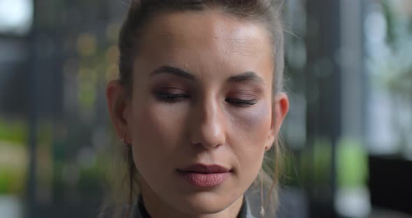 Confused Woman With Bruises Under The Eye Who Suffered Domestic Violence alt