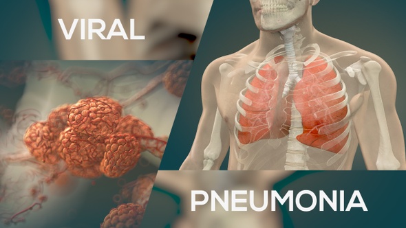will viral pneumonia go away