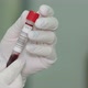 Medical Worker Examines A Vial Of Blood - VideoHive Item for Sale