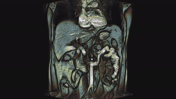 Bulk Multicolored CT Scan of the Abdomen alt