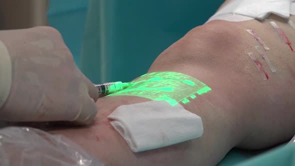 Varicose, Sclerotherapy and Vein Viewer