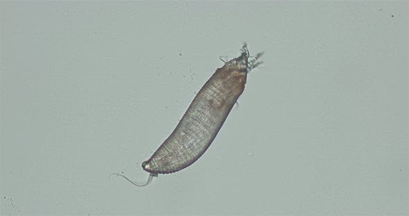 Gall mites Eriophyoidea under the microscope, Phytoptidae family alt