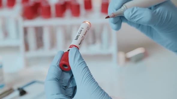 Close Up of Tube with Positive Test SARS-CoV-2 in Hands alt