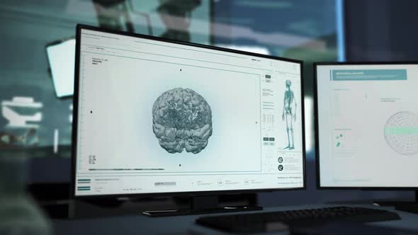 Modern medical x-ray equipment noticed a cancerous tumor in a patients brain alt