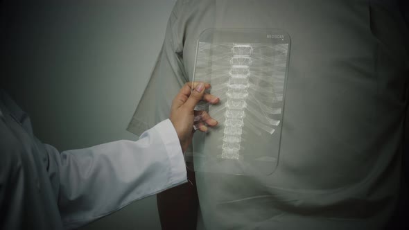 A Doctor Scanning Patient's Backbone