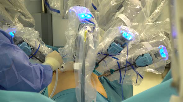 Prostate Surgery With Robot Hand